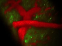 Снимок SCAPE-микроскопа Снимок SCAPE-микроскопа