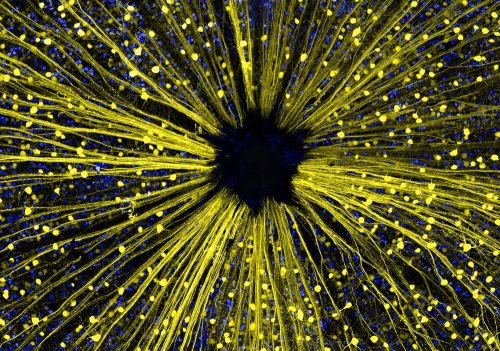 14 �����. Nikon Small World 2016
