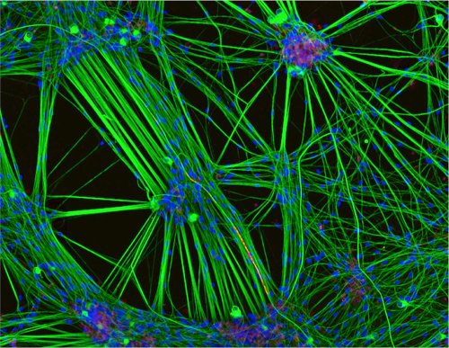 3 �����. Nikon Small World 2016