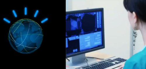 Суперкомпьютер Watson